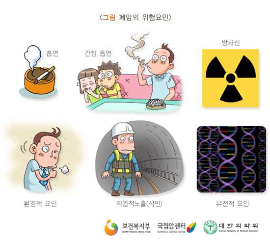 폐암의 위험요인