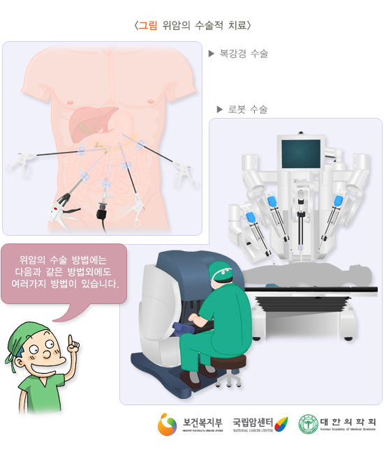 위암의 수술적 치료