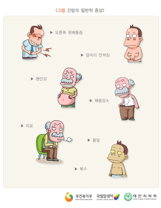 간암의 일반적 증상